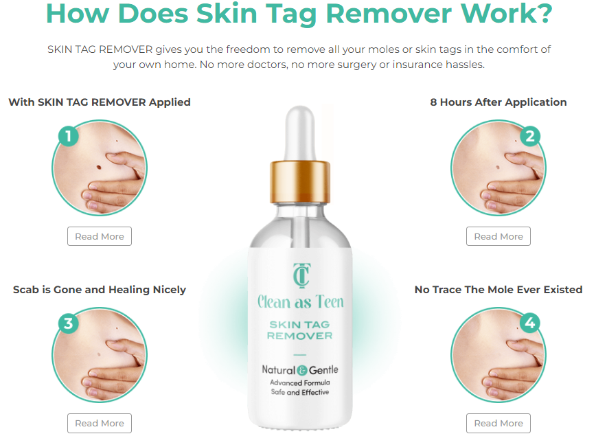 Clean As Teen Skin Tag Remover scam